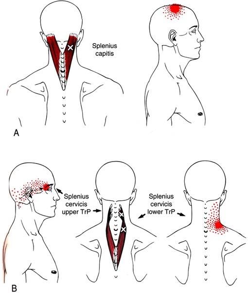 Ременные мышцы головы и шеи (m. Splenius)