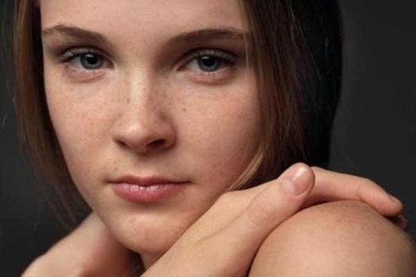 ПРОСТОЙ РЕЦЕПТ МАЗИ ОТ ПИГМЕНТНЫХ ПЯТЕН ПРОСТОЙ РЕЦЕПТ МАЗИ ОТ ПИГМЕНТНЫХ ПЯТЕН