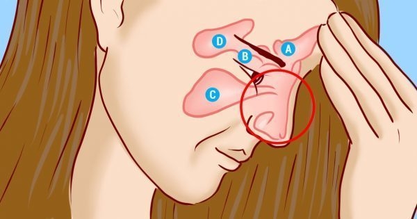 Избавься от инфекции носовых пазух всего за 5 минут! Знать бы этот метод раньше…