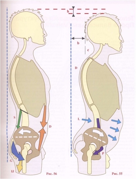 Мышцы передней брюшной стенки: выпрямление поясничного лордоза