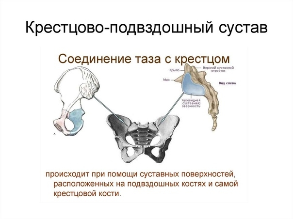 Коррекция правого крестцово-подвздошного сочленения Коррекция правого крестцово-подвздошного сочленения