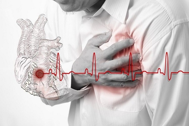 В случае сердечного приступа, у вас есть только 10 секунд, чтобы спасти свою жизнь! Вот, что необходимо делать!