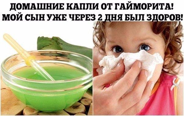ДОМАШНИЕ КАПЛИ ОТ ГАЙМОРИТА! МОЙ СЫН УЖЕ ЧЕРЕЗ 2 ДНЯ БЫЛ ЗДОРОВ!