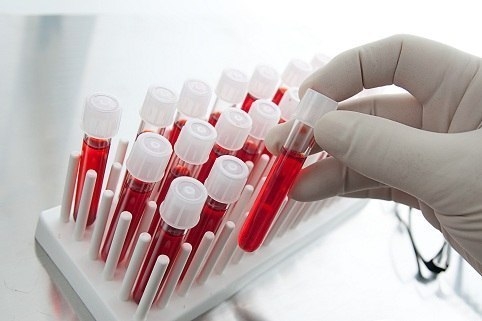 Расшифровка – общий анализ крови
