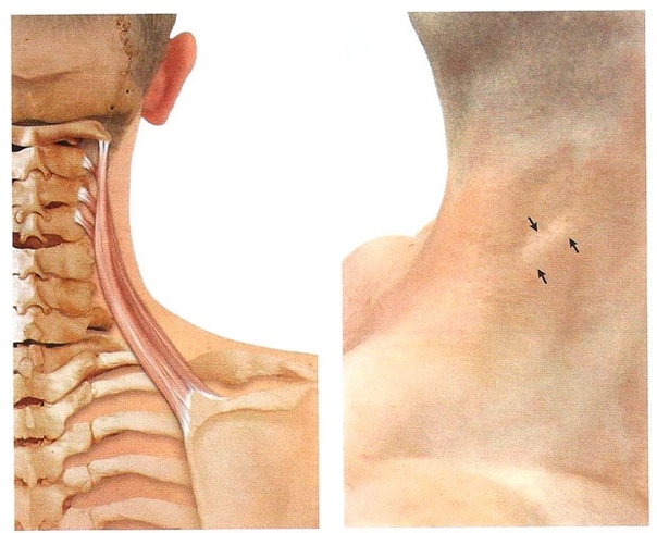 Трапециевидная мышца и мышца поднимающая лопатку