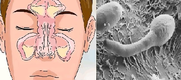Проблема заложенности вашего носа в вашем кишечнике