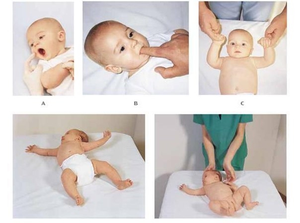 Физиологические безусловные рефлексы новорожденного