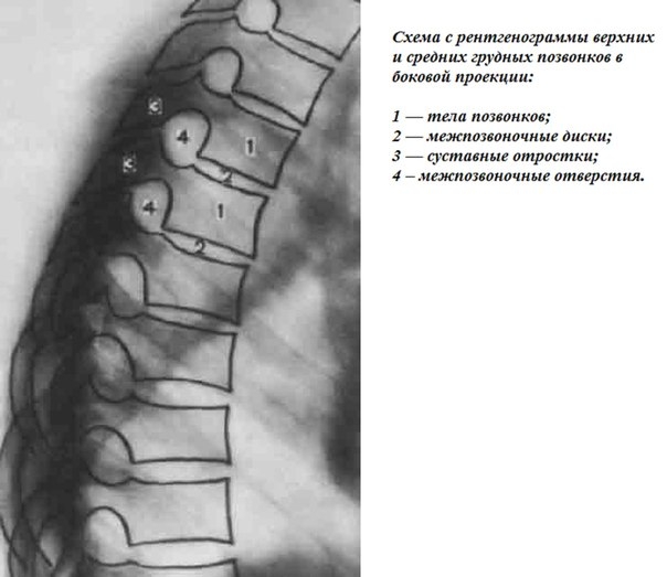 Позвонки и их соединения в рентгеновском изображении
